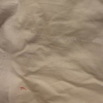 Yorganda Kırmızı Lekeler Ve Kaz Tüyü Kaçağı Nedeniyle Ayıplı Ürün Şikayeti