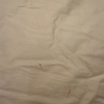 Yorganda Kırmızı Lekeler Ve Kaz Tüyü Kaçağı Nedeniyle Ayıplı Ürün Şikayeti