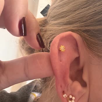 Yanıltıcı Küpe, Alerjik Şişme Ve Cevapsız İade Talebi