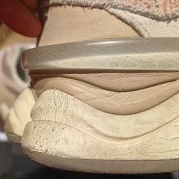 SuperStep Mağazasında New Balance Ayakkabısının Deformasyonu Ve Garantiden Olumsuz Dönüş