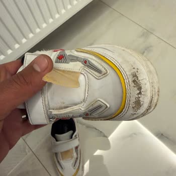 Çocuk Ayakkabısındaki Üretim Hatası Nedeniyle Değişim Ve İade Talebi