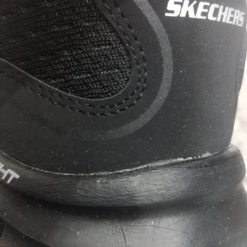 Kusurlu Skechers Ayakkabı Ve Yanıltıcı Görseller Nedeniyle İade Reddi