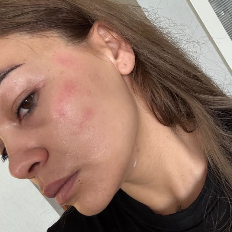 Aşırı Sıcak Ve Konforsuz Otobüs Yolculuğu Nedeniyle İade Talebi