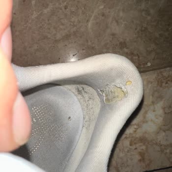 UA Infinite Pro Modelinde Tekrarlayan Topuk Yastıklama Aşınması Ve Yetersiz Müşteri Hizmeti