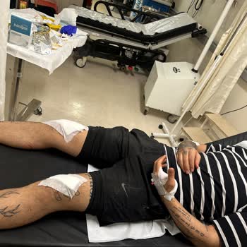 Sıfır Ödeyerek Aldığım Onvo Rx7 Scooter Yenilenmiş Çıktı, Beyin Yanması Ve Garanti İhmali