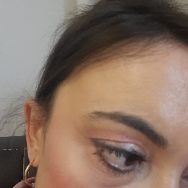 Estee Lauder Göz Kremi Şiddetli Tahriş, Yanık Ve Egzama Oluşturdu