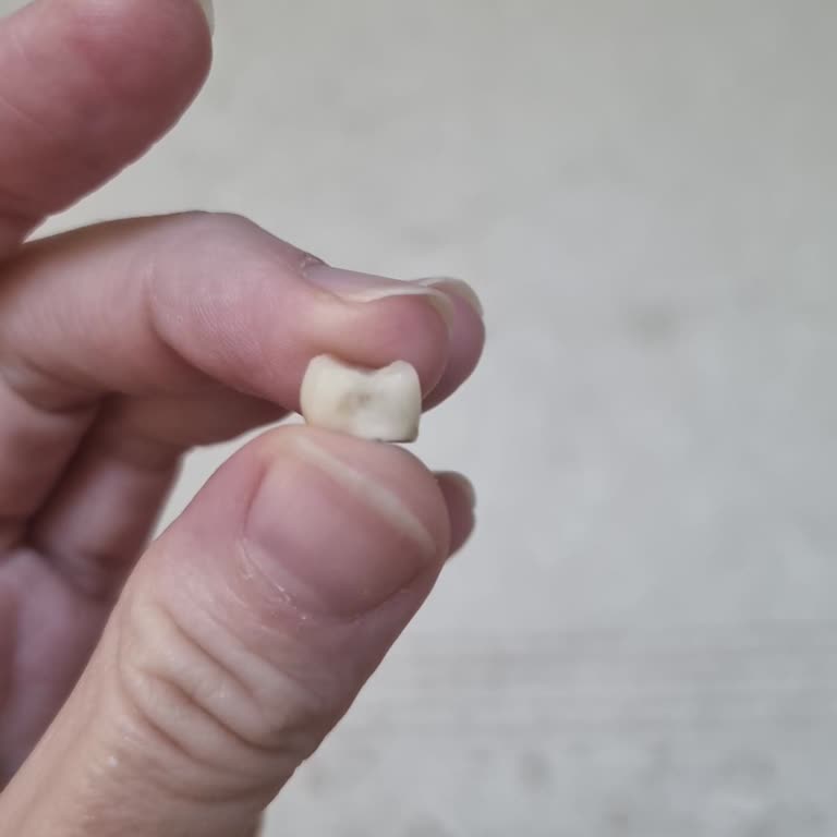 Dent Plus Ağız Ve Diş Sağlığı Polikliniği Manisa İmplantım Tam Üç Kez Düştü