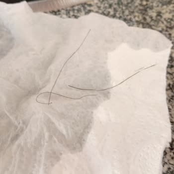 Getir Yiyeceklerde Hijyen Sorunu Var