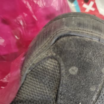 Ayakkabım 5 Ayda Önü Söküldü Üretici Kullanıcı Hatası Dedi Ve Değişim Talep Ediyorum