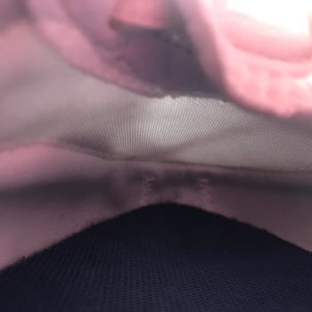 İç Dikiş Hatası Nedeniyle Ayağım Tahriş Oldu Ve Mağaza Süreci Uzadı