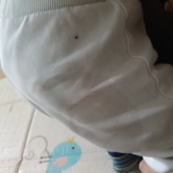 Molfix Double Soft 5 Numaralı Bezlerde Sızdırma Ve Pişik Problemi