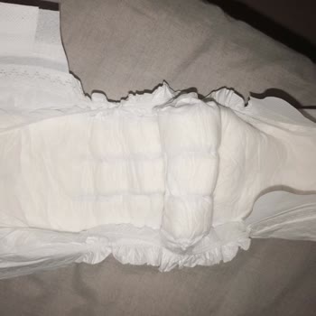 Sleepy Bebek Bezinde Çift Çizgi, Eksik Pamuk Ve Sızdırmazlık Sorunu