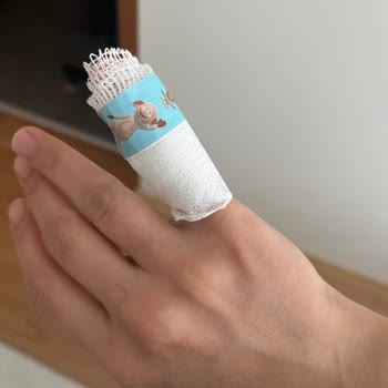 Metal Kap Keskin Köşesi Parmak Kesildi Ve İki Dikiş Gerekti