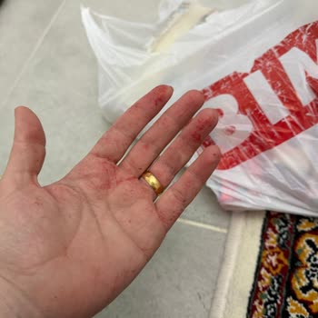 Poşet Boyası Sızıyor Ve Çözüm Bekliyor