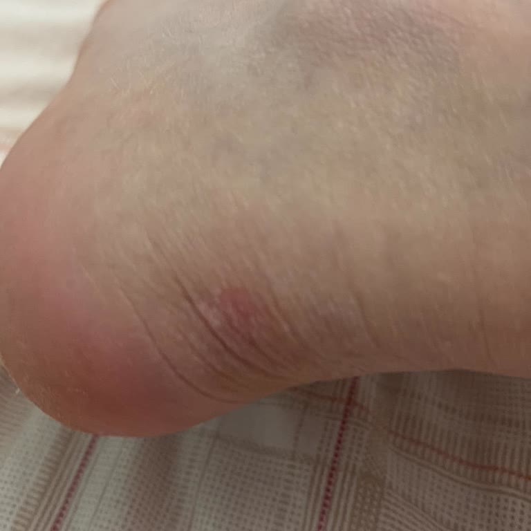 Sert Topuklu Skechers Kadın Outdoor Ayakkabısında Ağrı Ve İade Talebi