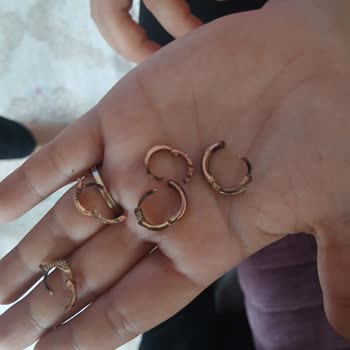 Migros Çelik Takısı Karardı, Kulak Yarası Oluştu Ve Şikayetime Cevap Gelmedi