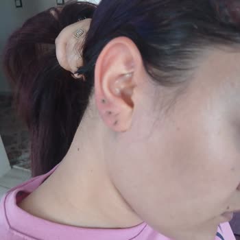 Migros Çelik Takısı Karardı, Kulak Yarası Oluştu Ve Şikayetime Cevap Gelmedi