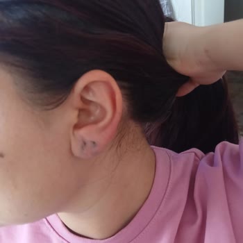 Migros Çelik Takısı Karardı, Kulak Yarası Oluştu Ve Şikayetime Cevap Gelmedi