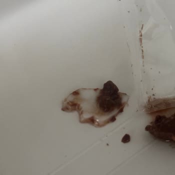 Vince Çikolatasında Çıkan Sert Parçadan Ölümcül Tehlike