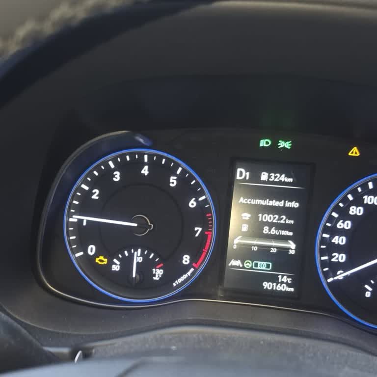 Hyundai Yetkili Servisinde 2 Ay Parça Bekleme Ve Garanti Kapsamı Belirsizliği