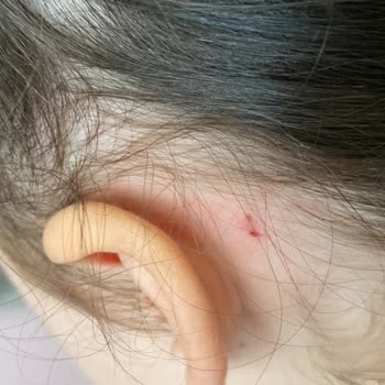 Kemalpaşa Belediyesi (İzmir) Kreşte Çocuğuma Uygulanan Fiziksel Şiddet Ve İhmal