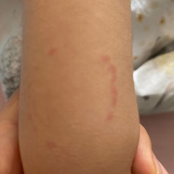 Kemalpaşa Belediyesi (İzmir) Kreşte Çocuğuma Uygulanan Fiziksel Şiddet Ve İhmal