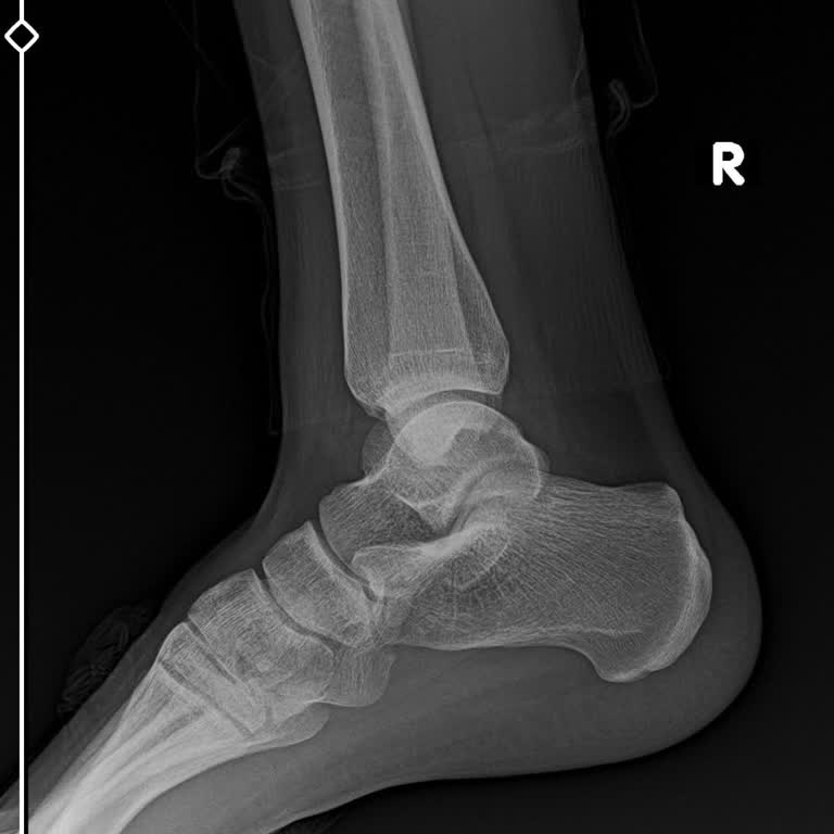 Erdem Hastanesi Yanlış Teşhis Ve Eksik Tetkik Nedeniyle Yaşadığım Mağduriyet