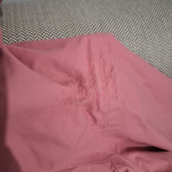 Cırt Cırt Nedeniyle Montta Kumaş Zedelenmesi Ve Boyner’in Geciken Değişim Süreci