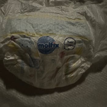 Molfix Bebek Bezinde Islaklık Göstergesi Olmadığı İçin Şikayet