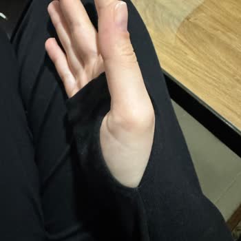 Üretim Hatası: Kol Açıklıklarındaki Asimetri Tişört Kalitesini Zedeliyor