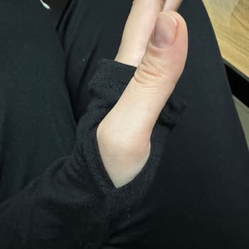 Üretim Hatası: Kol Açıklıklarındaki Asimetri Tişört Kalitesini Zedeliyor