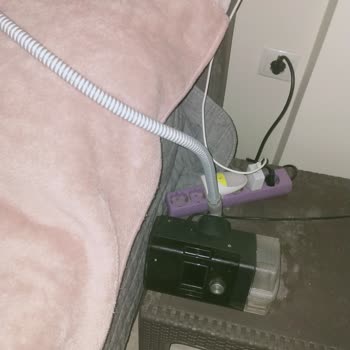Gece Süreklilik Gösteren Elektrik Kesintileri CPAP Cihazı İçin Hayati Risk Oluşturuyor