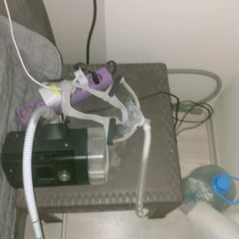Gece Süreklilik Gösteren Elektrik Kesintileri CPAP Cihazı İçin Hayati Risk Oluşturuyor