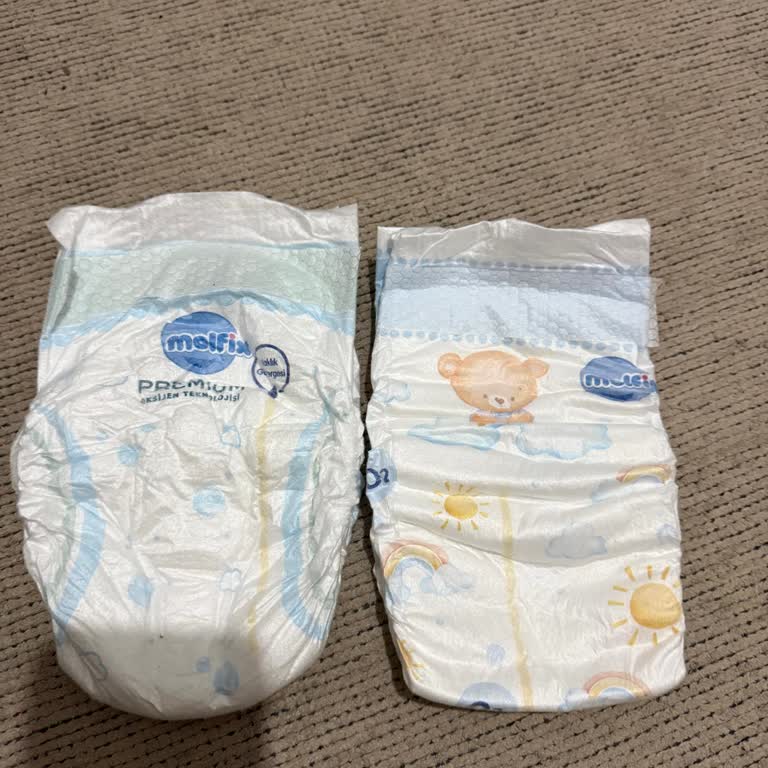 Molfix Premium 5 Numaralı Smart Fit Bezlerde Sızdırma Ve Bacak İzleri Sorunu