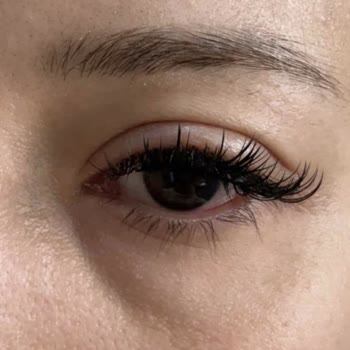 Yıldızca Beauty İpek Kirpik Uygulaması Sonrası Göz Ağrısı ve Şişmesi Nedeniyle Ücret İadesi Talebi