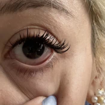 Yıldızca Beauty İpek Kirpik Uygulaması Sonrası Göz Ağrısı ve Şişmesi Nedeniyle Ücret İadesi Talebi