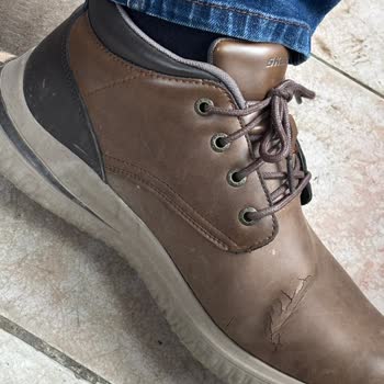 Skechers Mağazası Çatlamış Ayakkabının Teknik İncelemesini Reddetti