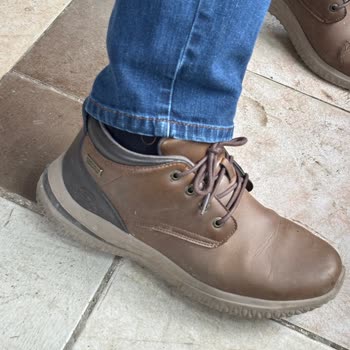 Skechers Mağazası Çatlamış Ayakkabının Teknik İncelemesini Reddetti