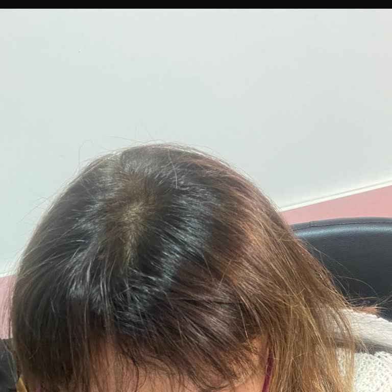 Zen Kuaför (Muğla) Hatalı Dip Boya Ve Renk Dengesizliği