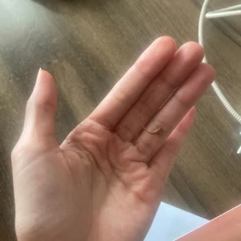 Metro Çikolatasının İçinden Saç Çıktı: Hijyen İhlali Ve Güven Sorunu