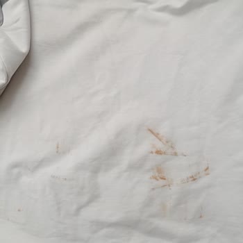 İki Yıllık Arçelik Çamaşır Makinesi Temizleme Sorunu Ve Değişim Talebi