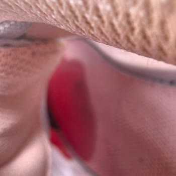 Decathlon Ayakkabısında Ciddi Ayak Yaralanması Ve Hatalı Ürün Değişimi Talebi