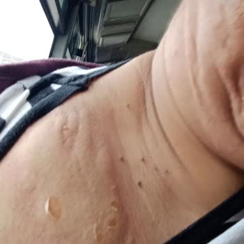 Mad Parfüm B107 Ürünü Nedeniyle Şiddetli Alerjik Reaksiyon Ve İade Talebi