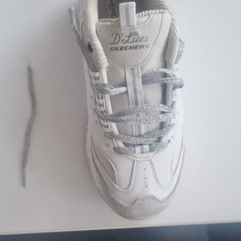 Skechers Ayakkabımın Bağcıkları Kısa Sürede Koptu Ve Değişim Talebim Reddedildi