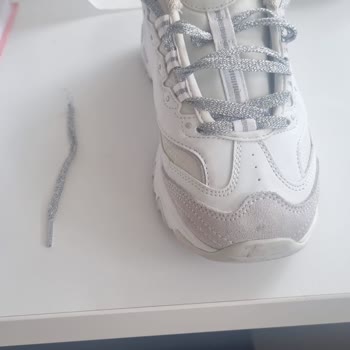 Skechers Ayakkabımın Bağcıkları Kısa Sürede Koptu Ve Değişim Talebim Reddedildi