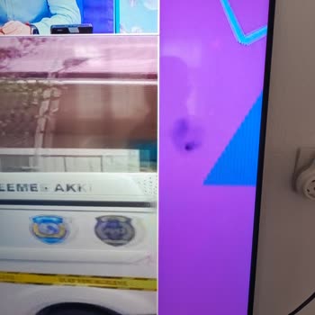 Onvo TV’de Tekrarlayan Görüntü Kesintileri Ve Kumanda Sorunları