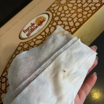 Faruk Güllüoğlu Dilovası Oksijen 3 Şubesinde Hijyen İhlali Ve Personel Hakareti