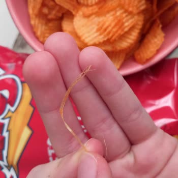Ruffles Paketi İçinde Tel Benzeri Yabancı Cisim Çıktı