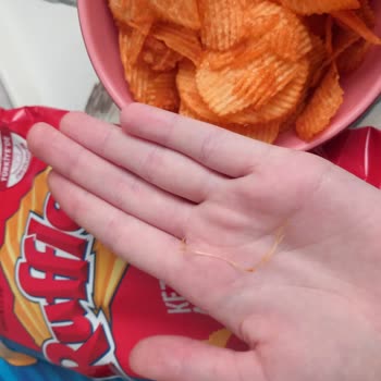 Ruffles Paketi İçinde Tel Benzeri Yabancı Cisim Çıktı