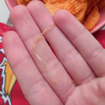 Ruffles Paketi İçinde Tel Benzeri Yabancı Cisim Çıktı